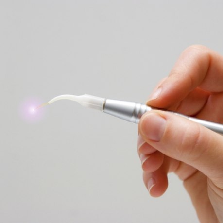 Hand holding a dental soft tissue laser