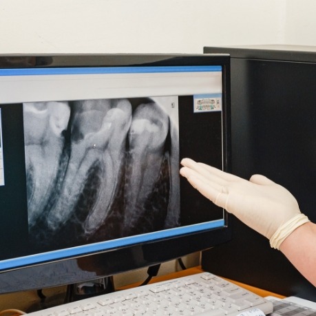 Dentist gesturing to digital dental x rays on computer screen